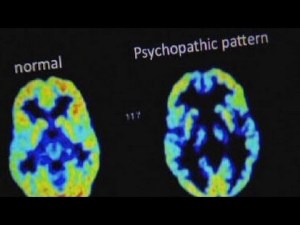 psychopath1